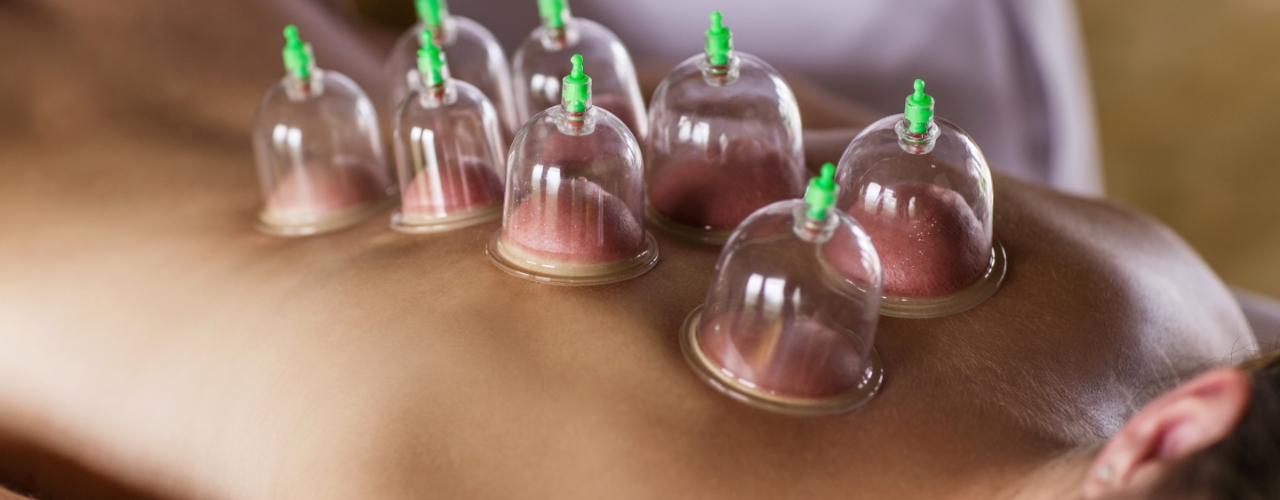 cupping-rhema-gold-physiotherapy-Calgary-AB