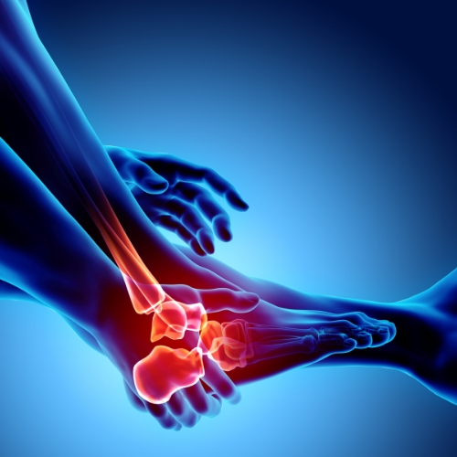 foot-pain-rhema-gold-physiotherapy-Calgary-AB