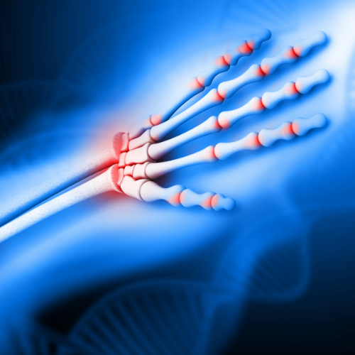 hand-pain-rhema-gold-physiotherapy-Calgary-AB