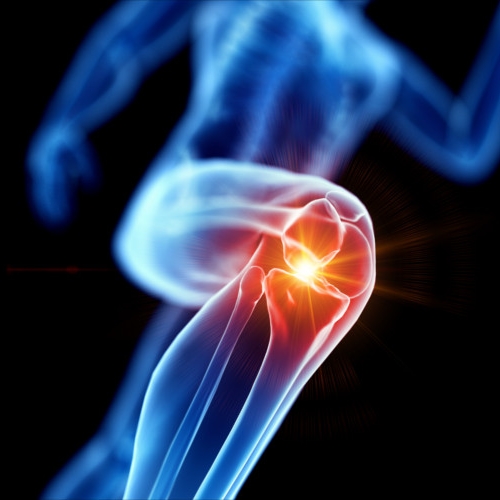 knee-pain-rhema-gold-physiotherapy-Calgary-AB
