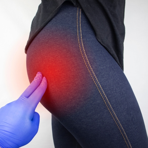 sciatica-pain-rhema-gold-physiotherapy-Calgary-AB